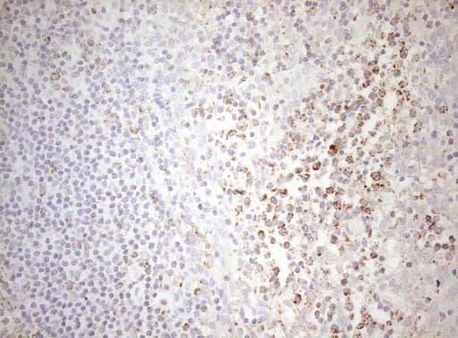 DECR1 Antibody (clone OTI7B11)