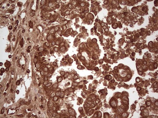 UBE2D2 / UBCH5B Antibody (clone OTI1D11)