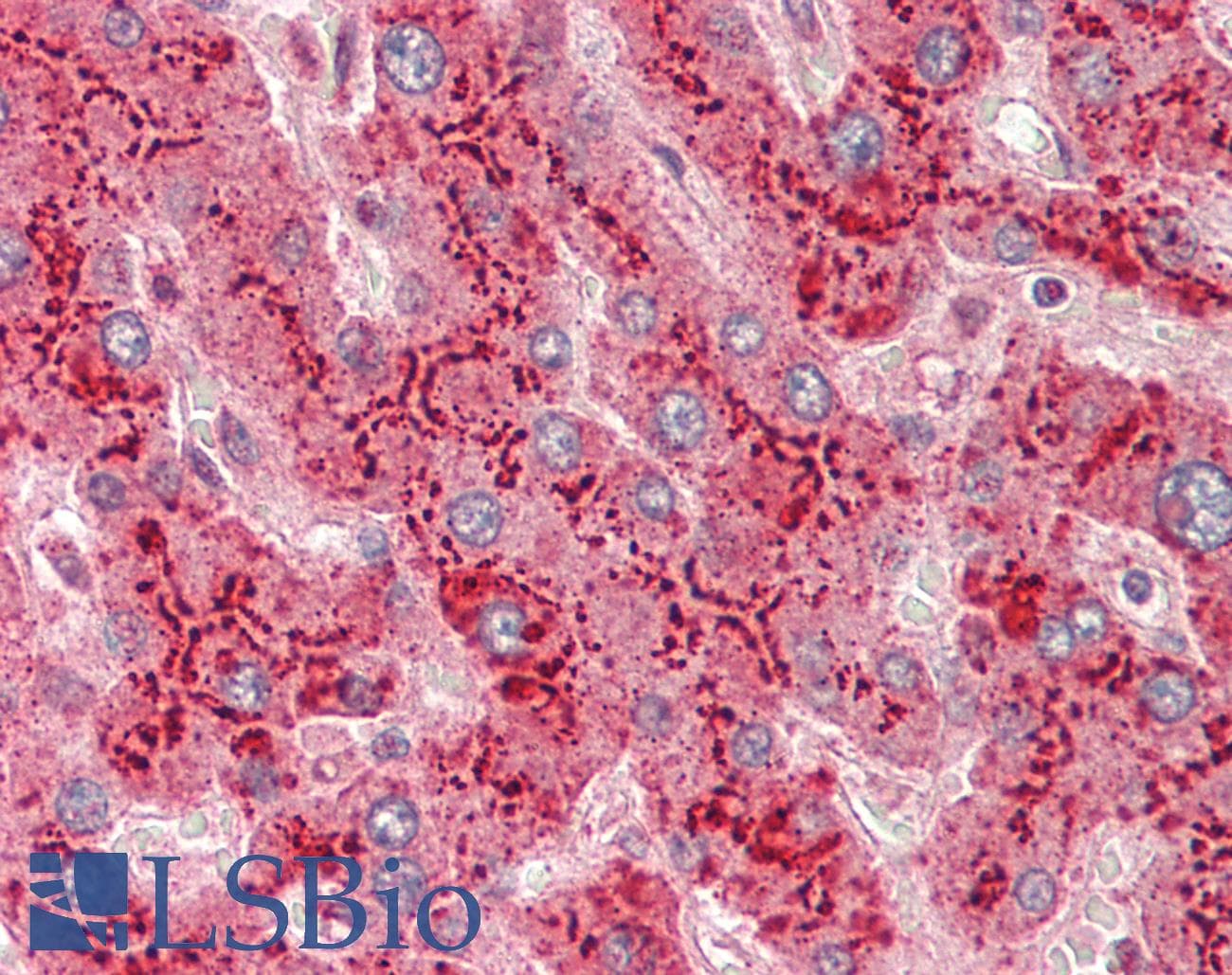 PathPlus™ Polyclonal Rabbit anti-Human SAA1 / SAA / Serum Amyloid A Antibody (aa1-106, IHC)