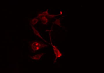 RALGAPA2 Antibody