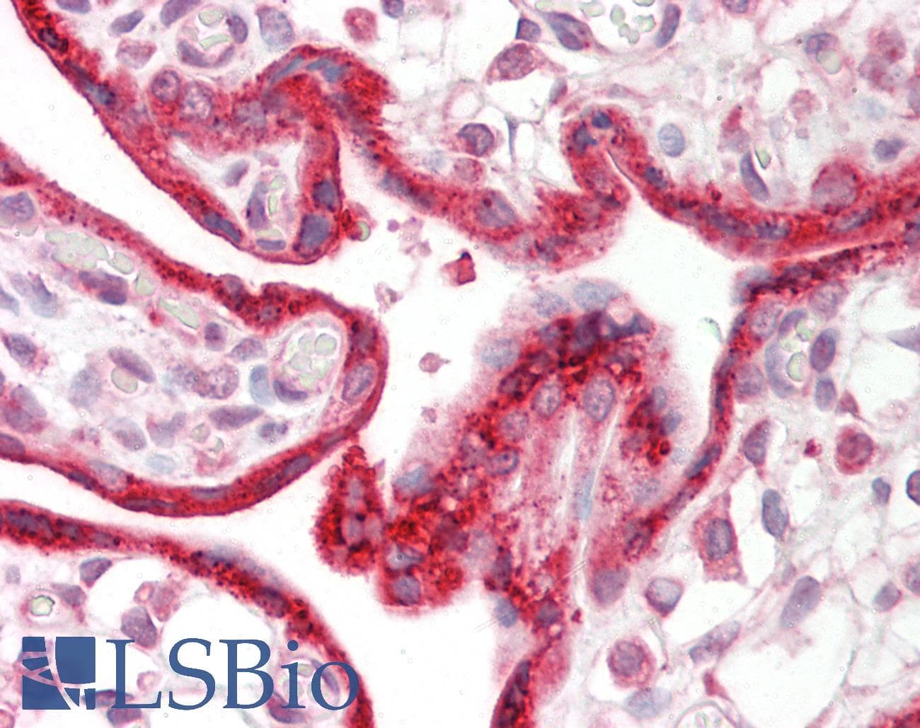 Polyclonal Rabbit anti-Human CKAP4 Antibody (C-Terminus, IHC, WB)