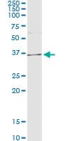 Monoclonal Mouse anti-Human AKR1D1 Antibody (clone 1A6, WB)