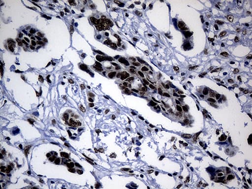 POLR2A / RNA polymerase II Antibody (aa1351-1614, clone OTI2B7)