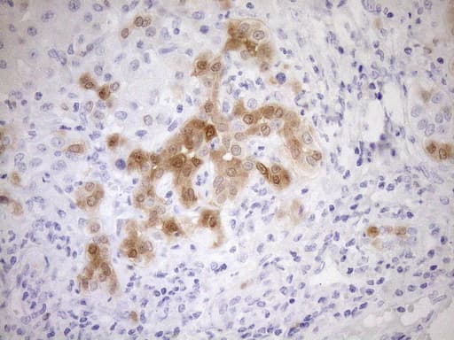 p16INK4a / CDKN2A Antibody (clone OTI3G3)
