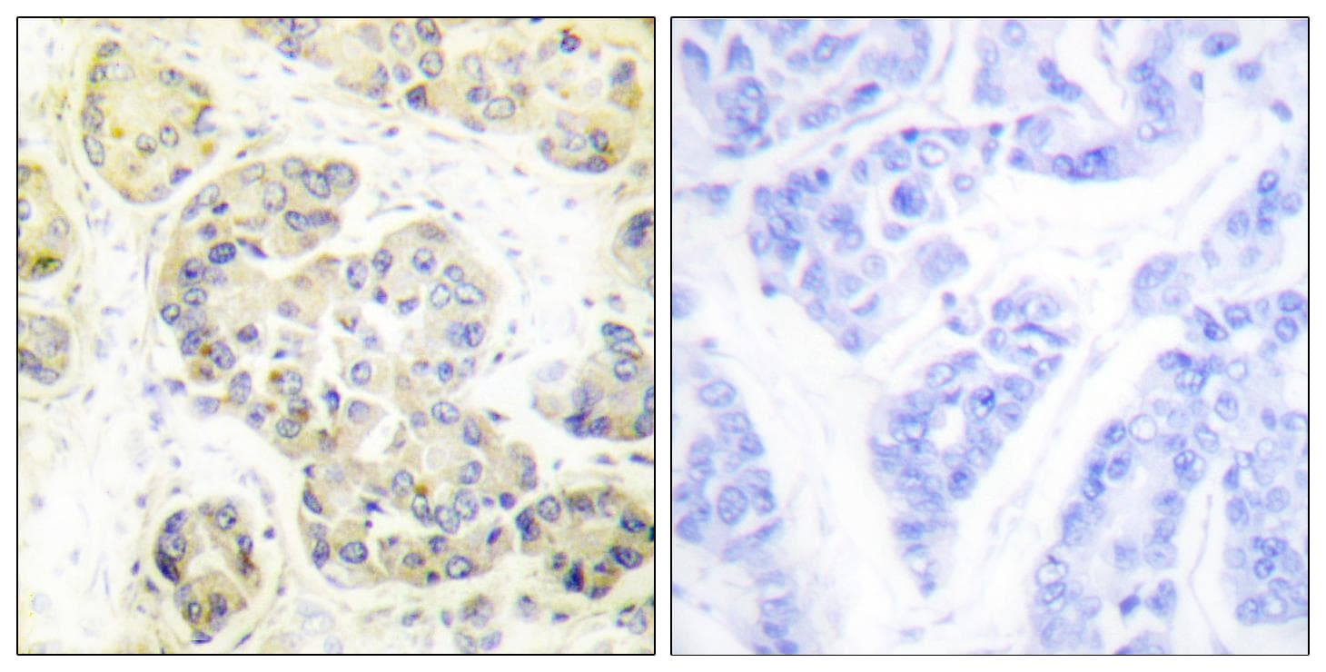 Polyclonal Rabbit anti-Human MARK1+2+3+4 Antibody (p215, IHC, IF, WB)