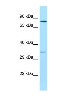 ENTPD6 Antibody (aa279-328)