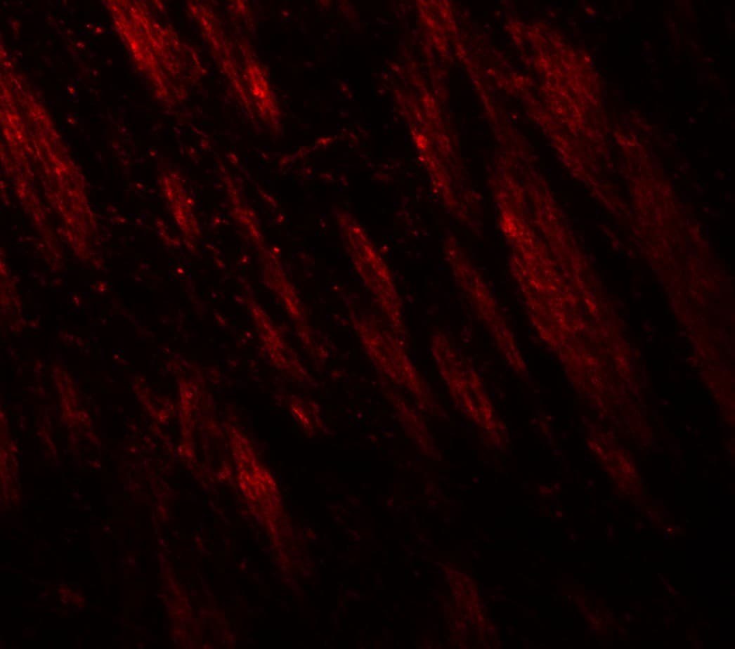 IHC-plus™ PTPN5 / STEP Antibody