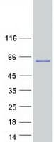 Human KCTD8 Protein (Recombinant Myc-DDK (Flag))