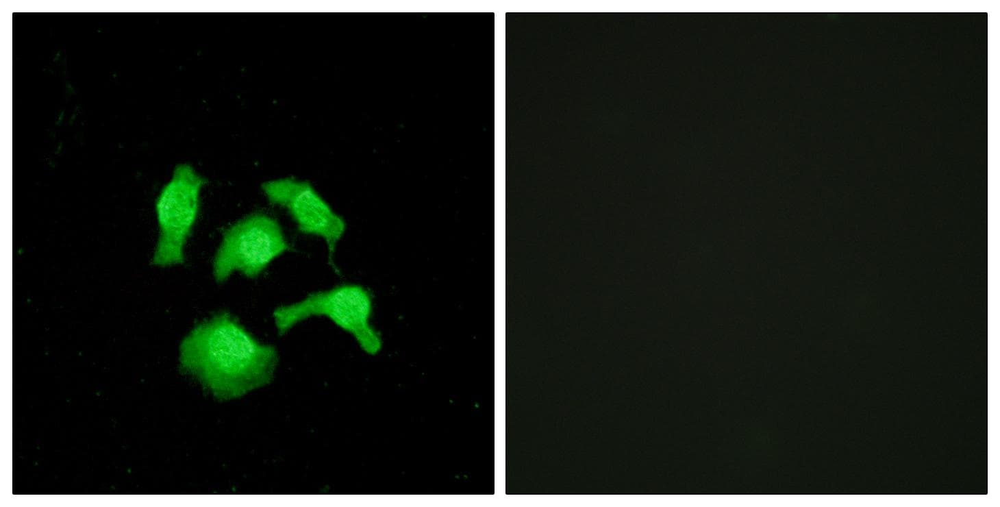 TSC22D1 / TSC22 Antibody