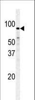 Polyclonal Rabbit anti-Human PFKM / PFK-1 Antibody (aa746-776, IHC, IF, WB)