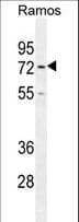 Polyclonal Rabbit anti-Human HMMR / CD168 / RHAMM Antibody (aa668-697, IHC, WB)