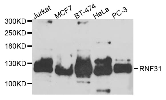 RNF31 Antibody