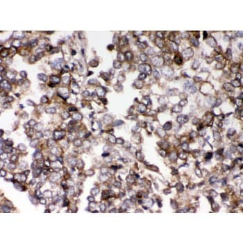 AIM2 Antibody (aa14-215)