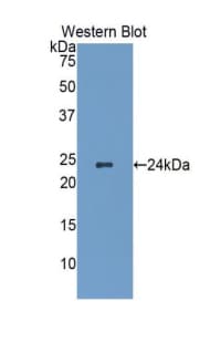 HSPB1 / HSP27 Antibody (aa2-205, APC)