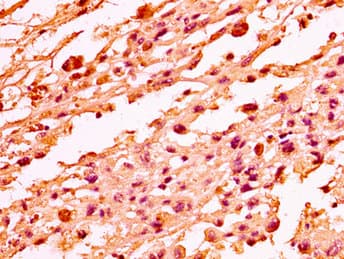 Polyclonal Rabbit anti-Human H1F0 Antibody (IHC, IF, WB)