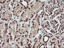 FAK / Focal Adhesion Kinase Antibody (clone OTI4D11)