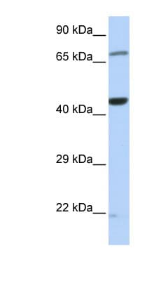 Polyclonal Rabbit anti-Human EFTU / TUFM Antibody (C-Terminus, WB)