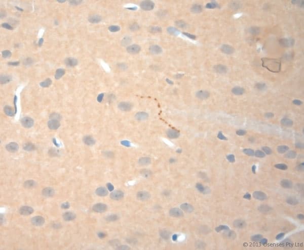 NGF Antibody (aa130-180)