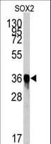 SOX2 Antibody (clone 57CT23.3.4)
