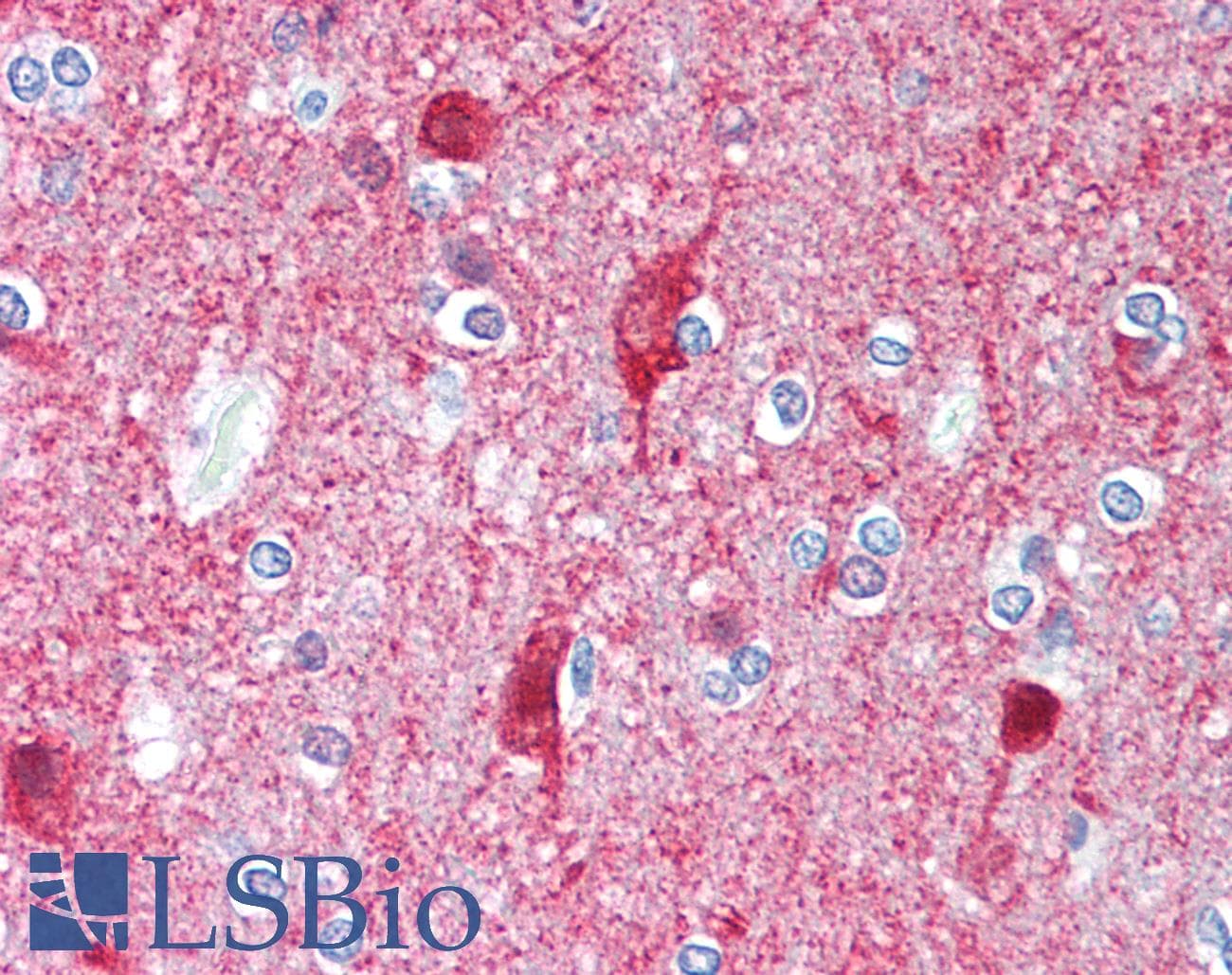 PathPlus™ UCHL1 / PGP9.5 Antibody