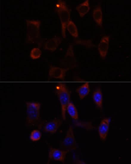 Polyclonal Rabbit anti-Human YTHDC2 Antibody (IF, WB)