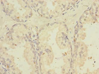 Polyclonal Rabbit anti-Human TNFSF15 / TL1A / VEGI Antibody (IHC)