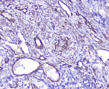 INPPL1 / SHIP2 Antibody