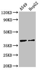CCR10 / GPR2 Antibody