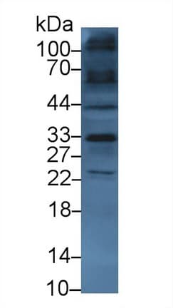 SLC9A3R2 / SIP1 Antibody (aa56-326, APC)
