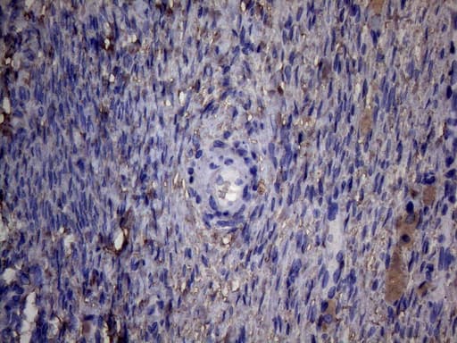 PAPSS2 Antibody (aa1-247, clone OTI6H10)
