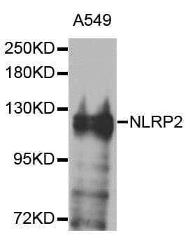 NLRP2 / NALP2 Antibody
