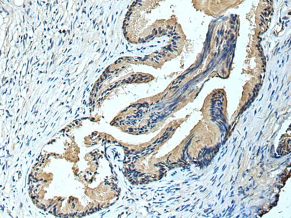 FCRLA Antibody