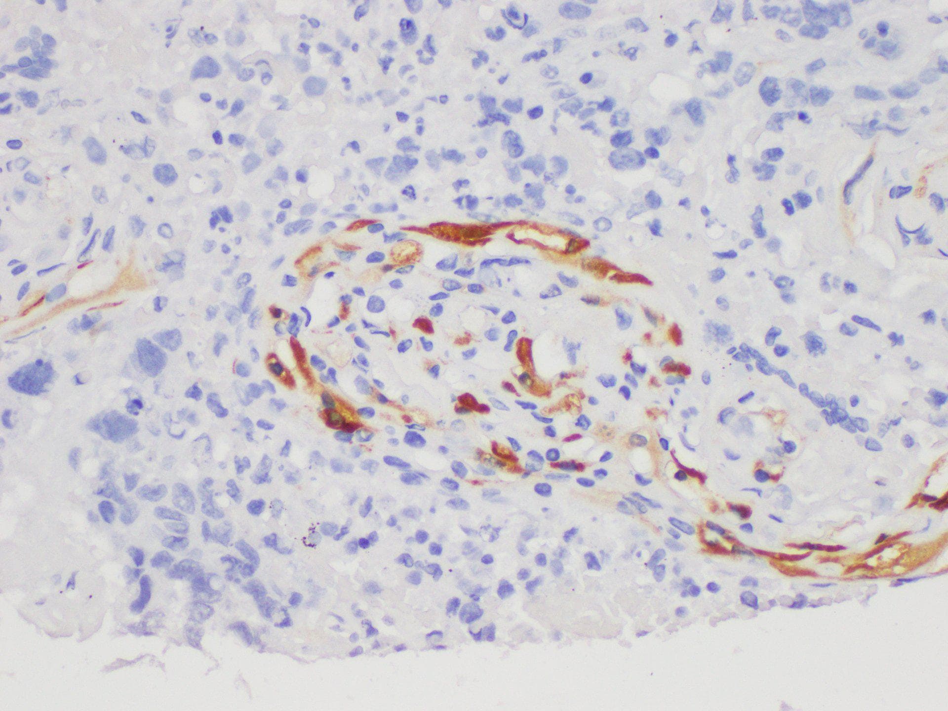 Polyclonal Rabbit anti-Human S100A7 / Psoriasin Antibody (IHC)