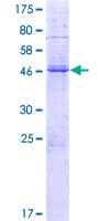 Human Klra1 / Ly49 Protein (Recombinant GST)