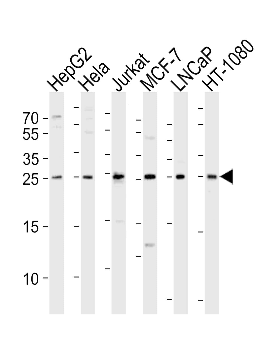 FGF8 Antibody (aa32-66)
