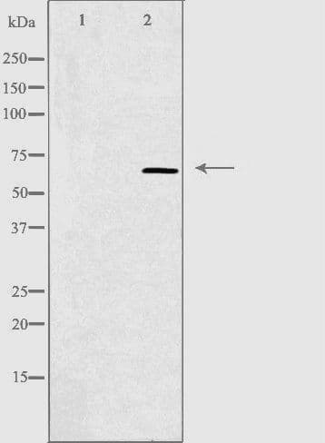 CCT5 / TCP1 Epsilon Antibody