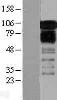 ZFPL1 Protein (Over-Expression Lysate Myc-DDK (Flag))