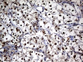 NBN / Nibrin Antibody (clone OTI3A2)