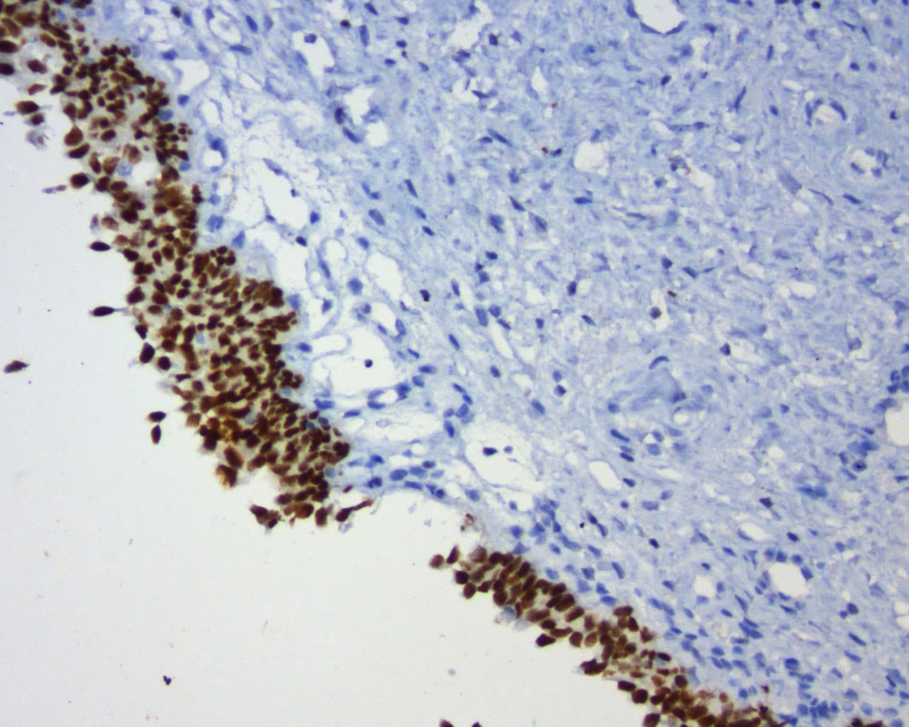 Monoclonal Mouse anti-Human GATA3 Antibody (clone UMAB218, Carrier-free, aa155-443, IHC, IF, WB)