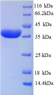 Rat HP / Haptoglobin Protein (Recombinant His)