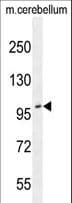 ADAMTS10 Antibody (aa210-240)