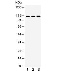 Polyclonal Rabbit anti-Human ITGA2B / CD41 Antibody (IHC, WB)