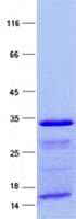 Human CDC42BPA / MRCK Protein (Recombinant His, N-Terminal)