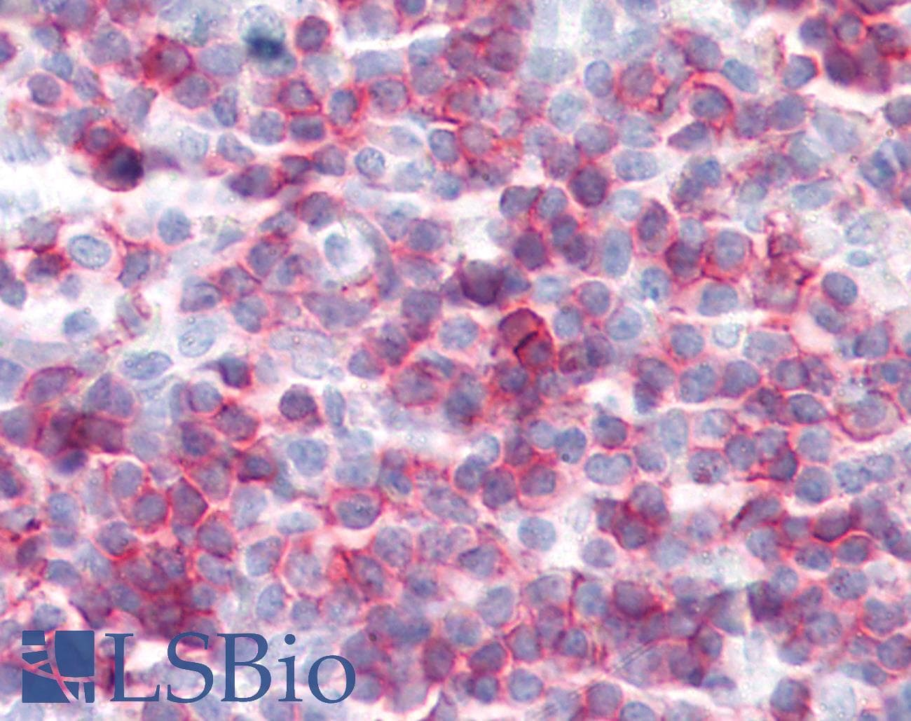 PathPlus™ Monoclonal Hamster-Armenian anti-Mouse CD27 Antibody (clone LG.3A10, IHC)