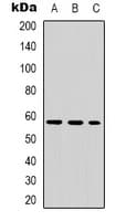 Polyclonal Rabbit anti-Human TH / Tyrosine Hydroxylase Antibody (N-Terminus, IHC, WB)