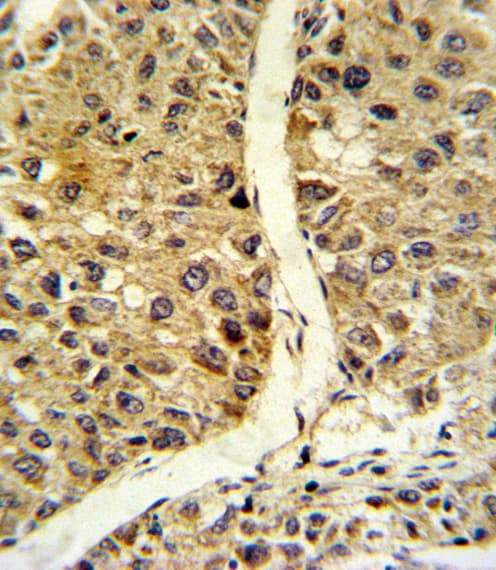 Polyclonal Rabbit anti-Human NOS3 / eNOS Antibody (aa48-75, IHC, IF, WB)