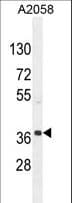 NKAPL Antibody (aa267-296)