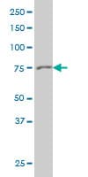 IHC-plus™ Monoclonal Mouse anti-Human GSN / Gelsolin Antibody (clone 3G5, IHC, WB)
