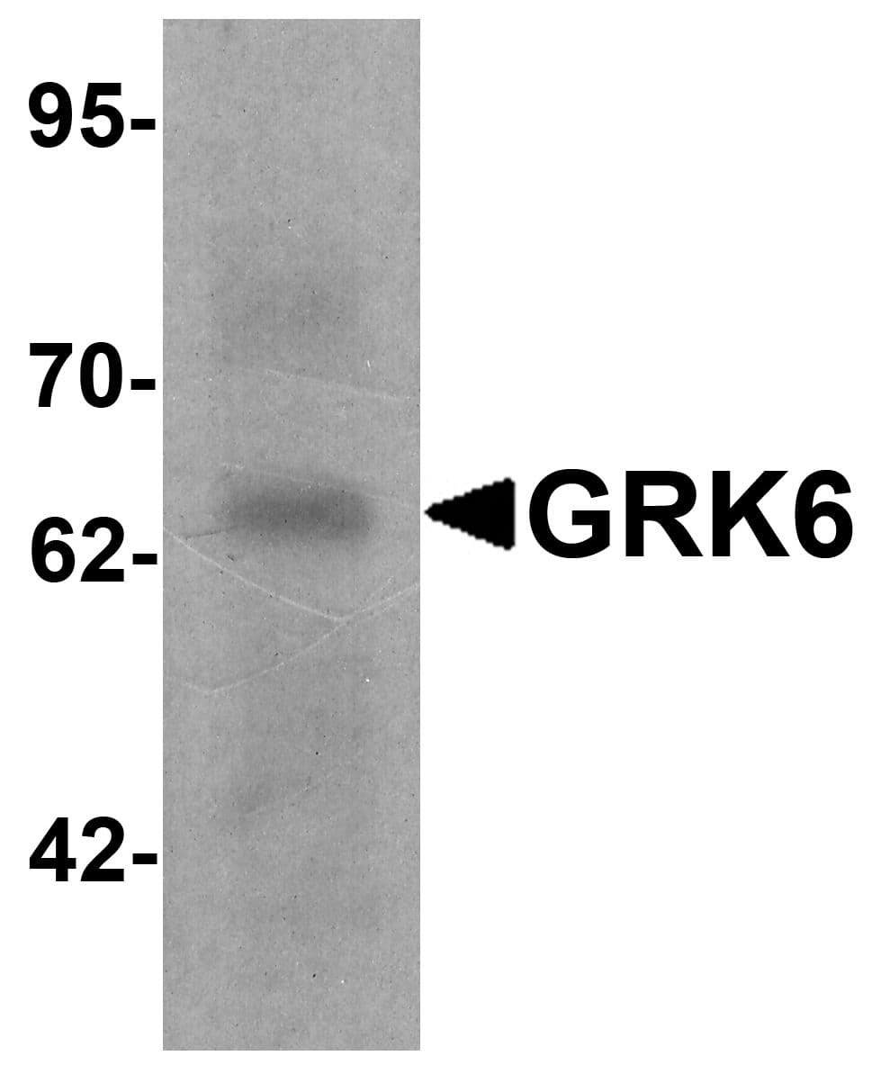 IHC-plus™ GRK6 Antibody