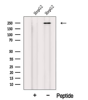 Polyclonal Rabbit anti-Human MED12 Antibody (WB)